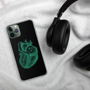 Green Heart Clear Case for iPhone® - MedTheories